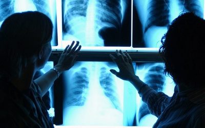 Названа привычка, которая вызывает 90% онкологических заболеваний