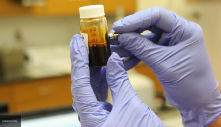 Ученые назвали наиболее частые передающиеся по наследству заболевания