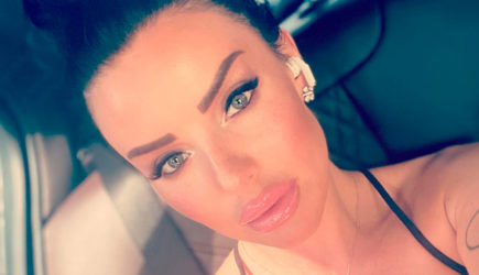 Экс-солистка &laquo;Тату&raquo; рассказала о сломавшем ей челюсть &laquo;нерусском мужчине&raquo;