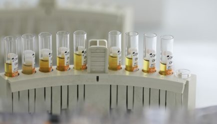 Предсказать можно: Учёные назвали фактор преждевременной смерти мужчин