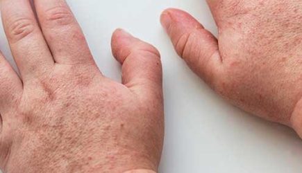 Людей предупредили о масштабной катастрофе не хуже, чем COVID