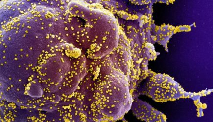 Вашингтон назвал «самую достоверную» версию происхождения коронавируса