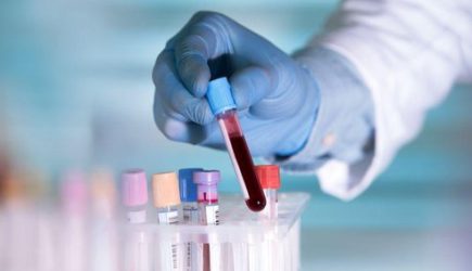 Человек — инкубатор для ковида: новое открытие ученых