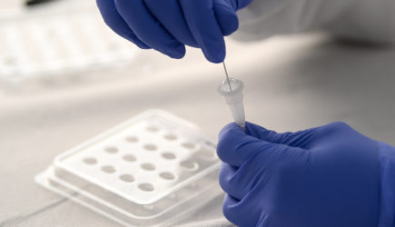 Не рискуйте, проверьте: Врач назвала два важных анализа перед прививкой от COVID-19