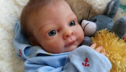 Девочка-паук родилась с восемью конечностями