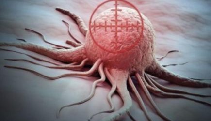 Этот симптом проявляется за 20 лет до диагностики рака