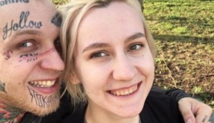 Сын-фрик Яковлевой после операции стал красавцем