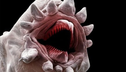 7 признаков того, что организм заражен опасными червями