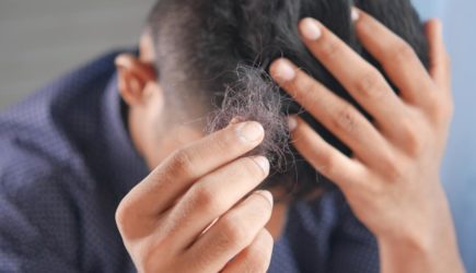 Почему выпадают волосы: врач назвала основные причины