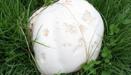 У россиянки неожиданно выросло гигантское «яйцо динозавра»