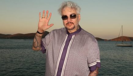 Не заживают месяцами: Киркоров показал жуткие ожоги после трагедии