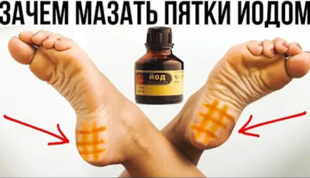 Неоценимая польза йода: зачем им мажут пятки