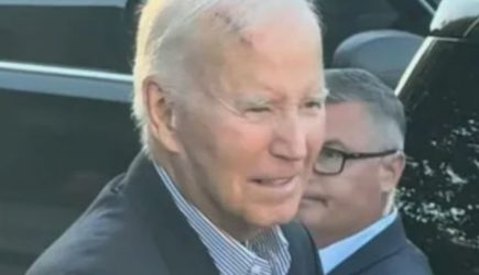 Байден появился на&nbsp;публике с&nbsp;гигантским шрамом на&nbsp;голове