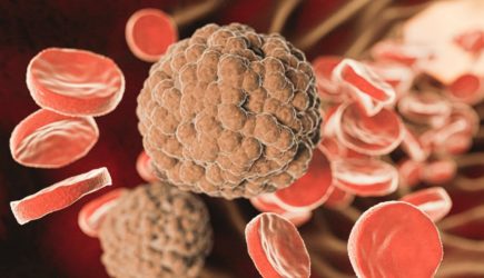 «Чистка сосудов» без таблеток: эксперт назвала 10 продуктов, которые снижают «плохой» холестерин