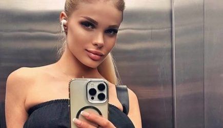 Избитая бойфрендом российская инста-модель забыла о сыне после трепанации черепа