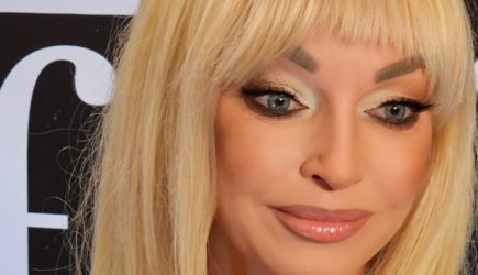 Волочкова честно рассказала всю правду об операции в Германии