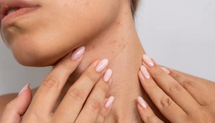 Девушка начала сильно чесаться и оказалась больна раком